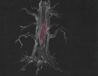 5543721 Fearsome Wilderness